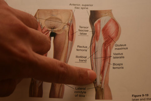 長時間騎單車，擴筋膜張肌反覆摩擦股骨上踝，很容易導致「髂脛束摩擦症候群」。（圖片提供／台中慈濟醫院）