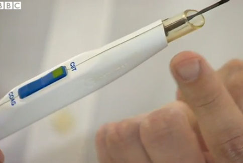 英國研究團隊研發出智慧型手術刀，可以快速偵測出體內有無癌組織。（圖片／取材自英國《BBC》）